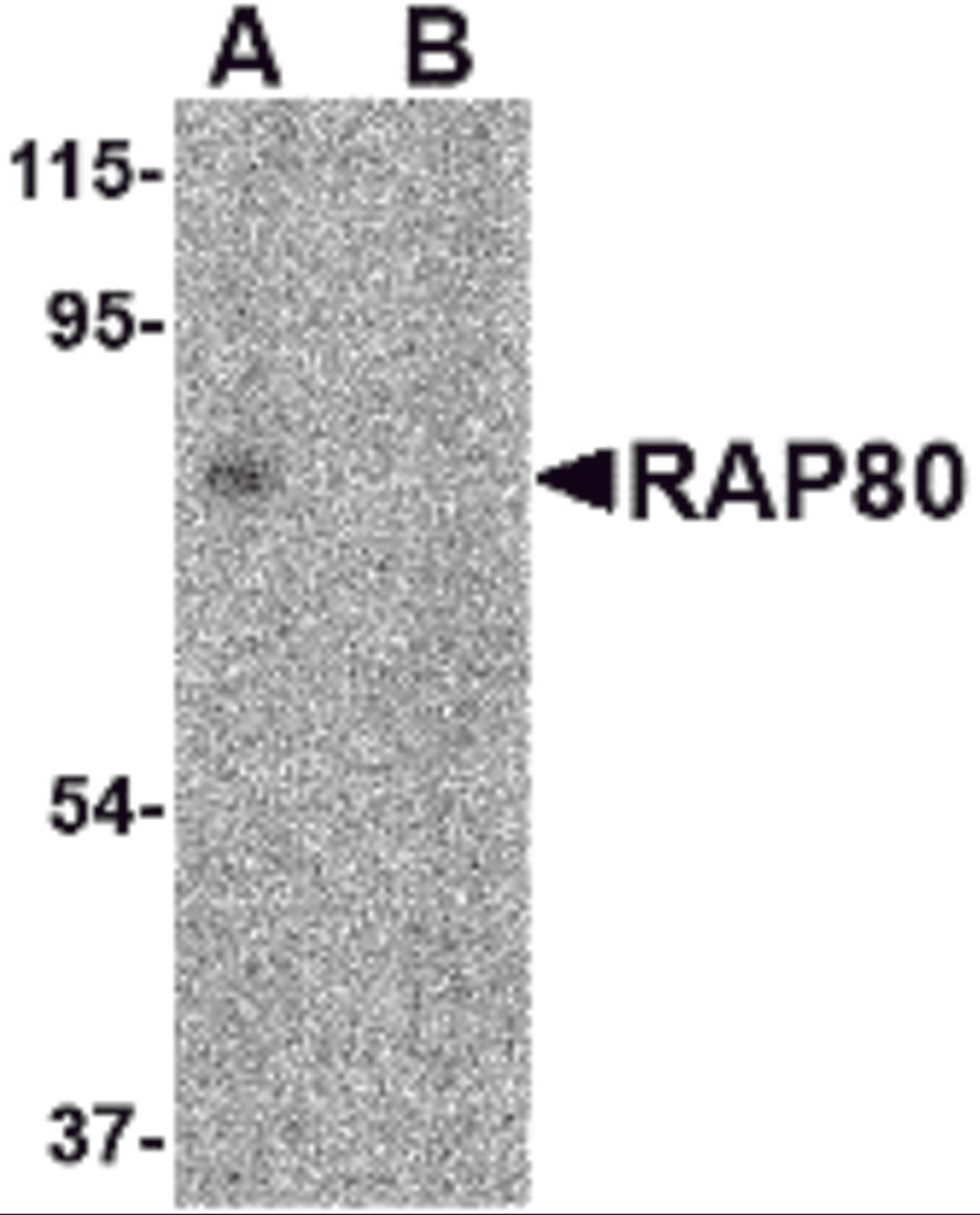 Western blot analysis of RAP80 in 293 cell lysate in (A) the absence and (B) presence of blocking peptide with RAP80 antibody at 2 μg/mL.