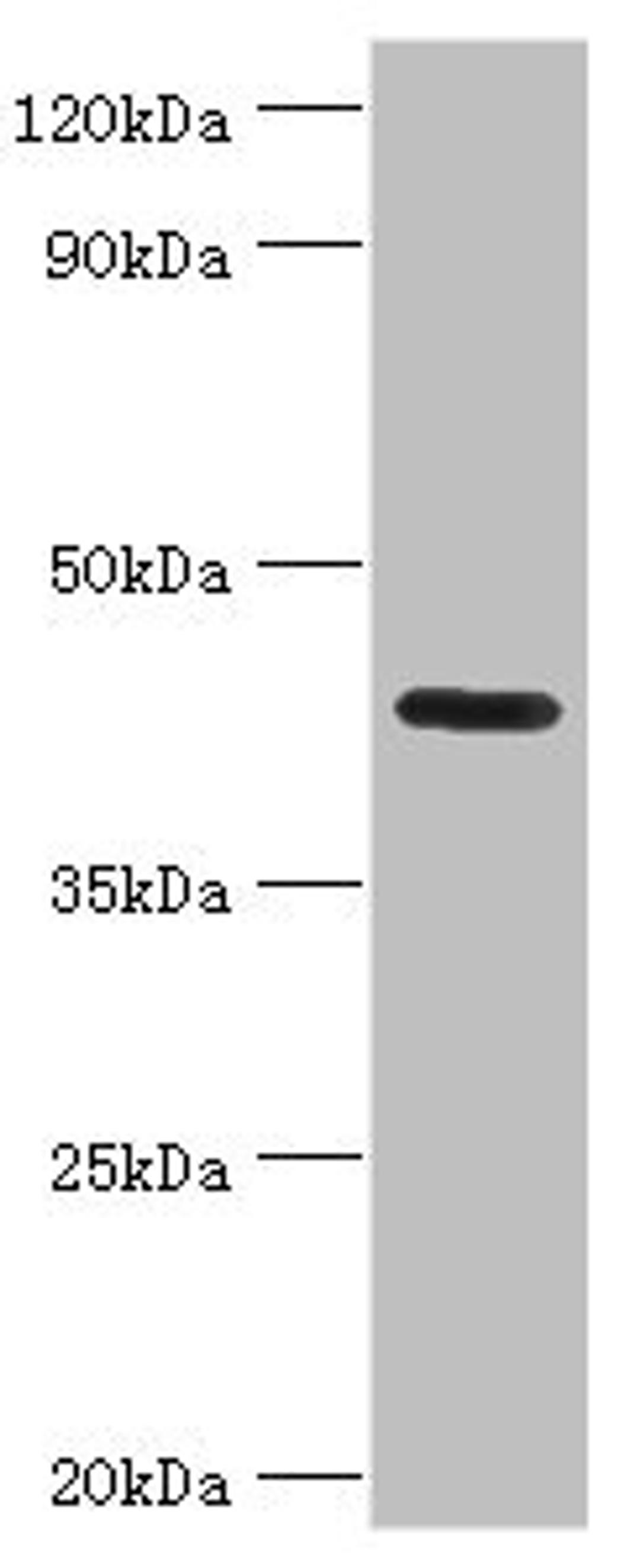 Western blot. All lanes: Nitrogen permease regulator 2-like protein antibody at 7ug/ml + Mouse skeletal muscle tissue. Secondary. Goat polyclonal to rabbit IgG at 1/10000 dilution. Predicted band size: 44, 24 kDa. Observed band size: 44 kDa. 