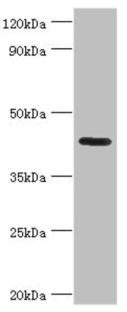 Western blot. All lanes: Nitrogen permease regulator 2-like protein antibody at 7ug/ml + Mouse skeletal muscle tissue. Secondary. Goat polyclonal to rabbit IgG at 1/10000 dilution. Predicted band size: 44, 24 kDa. Observed band size: 44 kDa. 