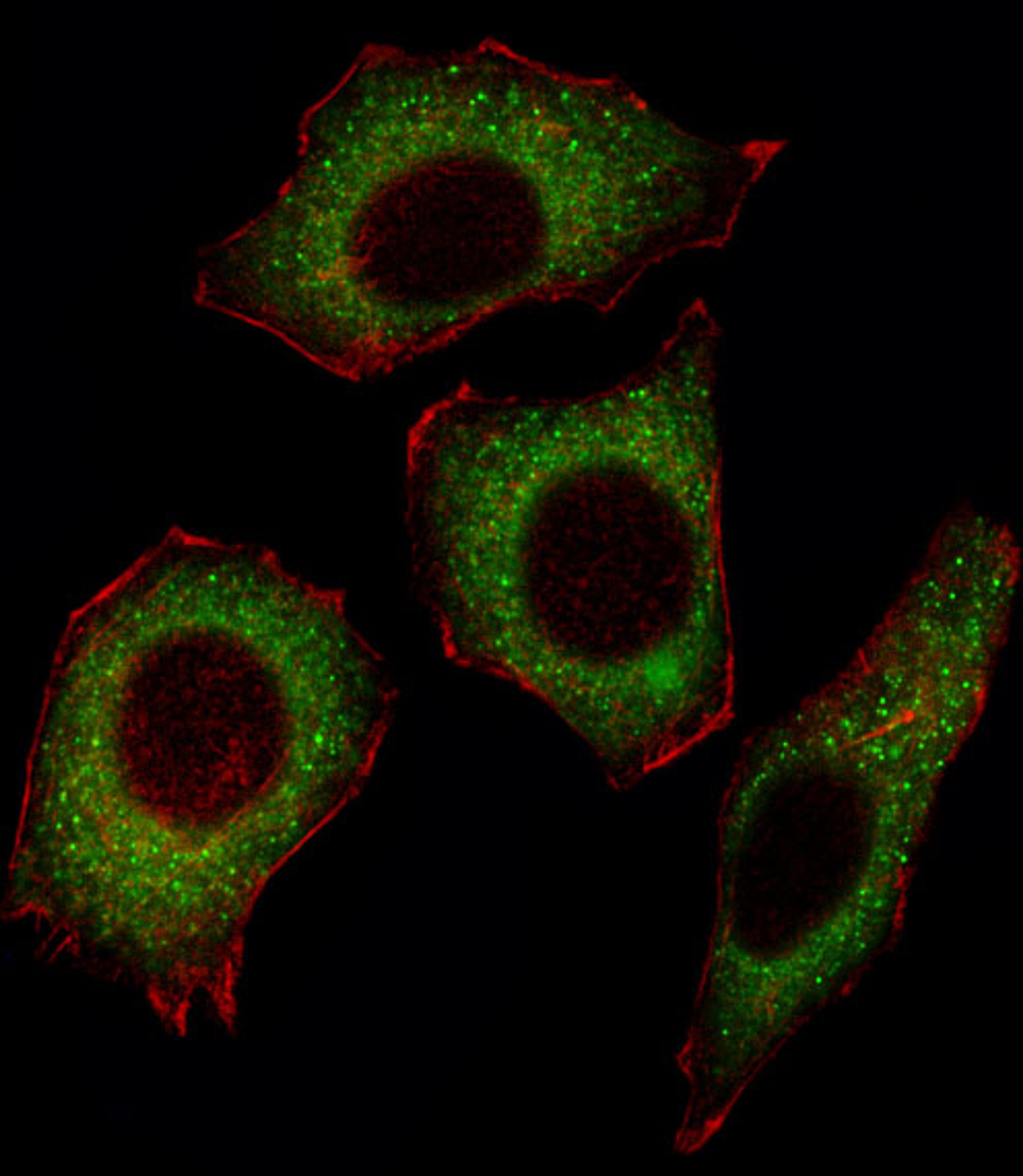 Fluorescent image of U251 cell stained with NFKBp65 Antibody(C-termS536).U251 cells were fixed with 4% PFA (20 min), permeabilized with Triton X-100 (0.1%, 10 min), then incubated with NFKBp65 primary antibody (1:25). For secondary antibody, Alexa Fluor 4