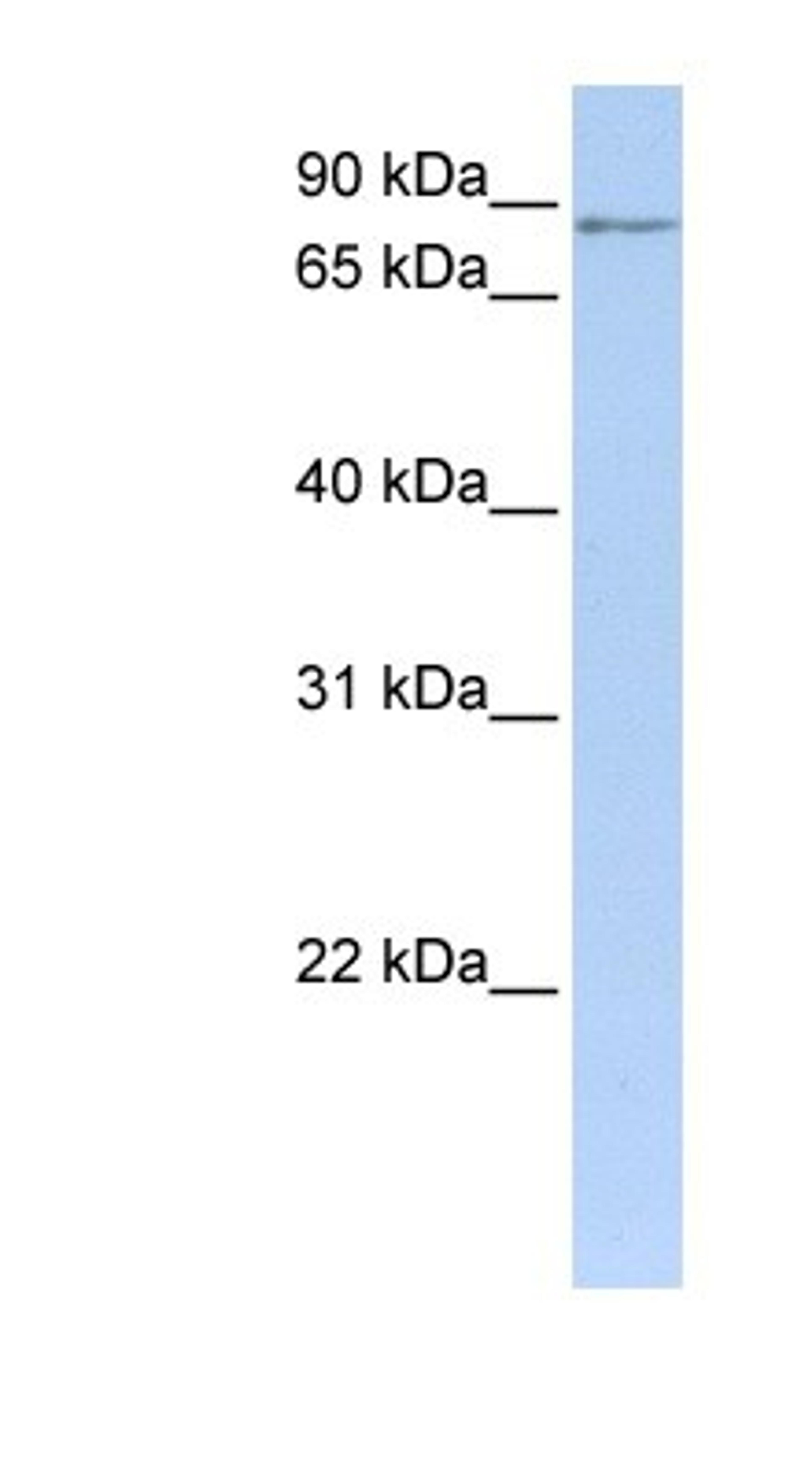 Western Blot: MTO1 Antibody [NBP1-54767] - Titration: 0.2-1 ug/ml, Positive Control: Human Muscle.