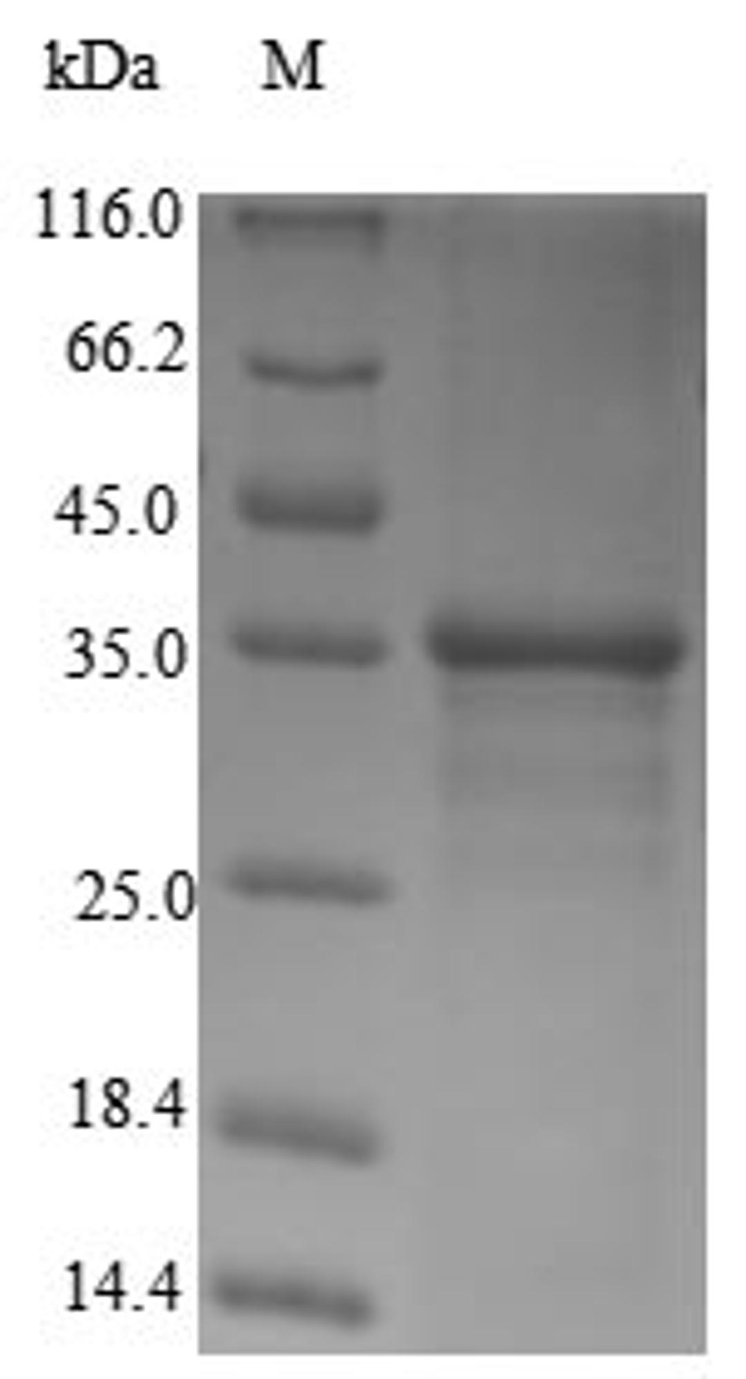 (Tris-Glycine gel) Discontinuous SDS-PAGE (reduced) with 5% enrichment gel and 15% separation gel.