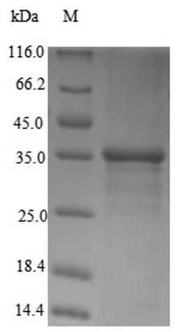 (Tris-Glycine gel) Discontinuous SDS-PAGE (reduced) with 5% enrichment gel and 15% separation gel.