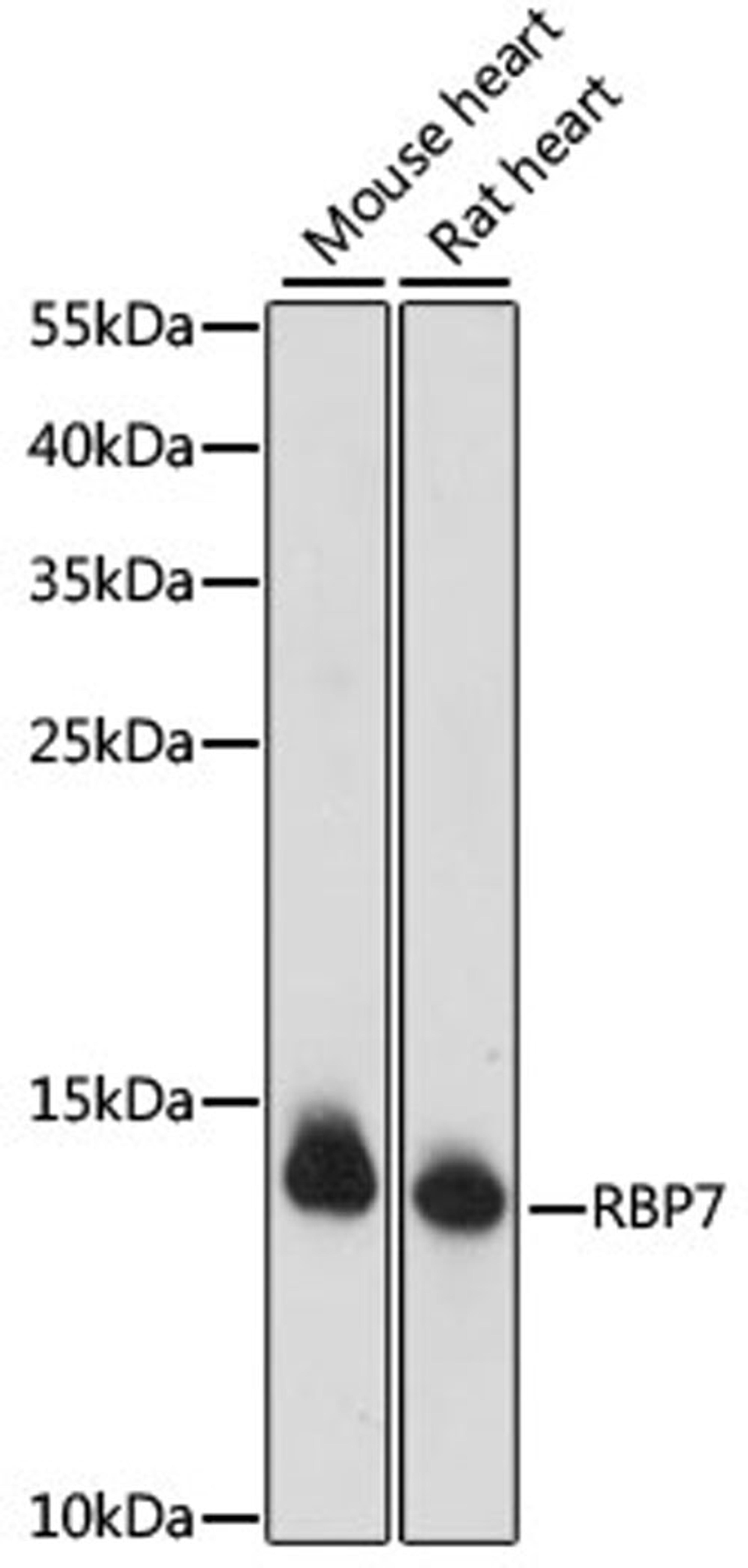 Western blot - RBP7 antibody (A15939)