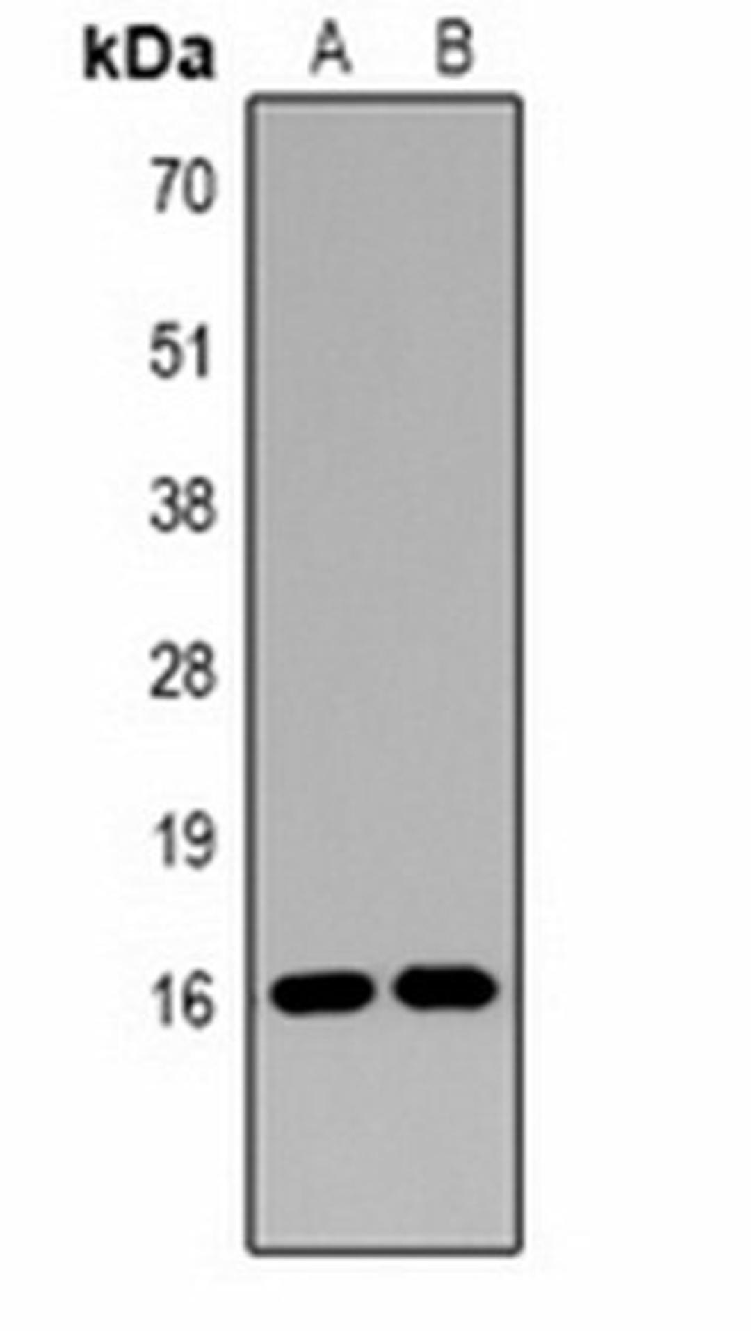 Western blot analysis of  Hela (Lane1), rat testis (Lane2) whole cell lysates using Histone H3 (DiMethyl K14) antibody