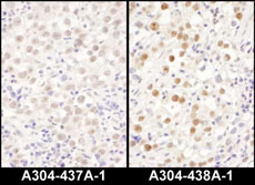 Detection of human LAS1L by immunohistochemistry.