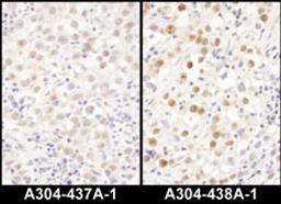 Detection of human LAS1L by immunohistochemistry.