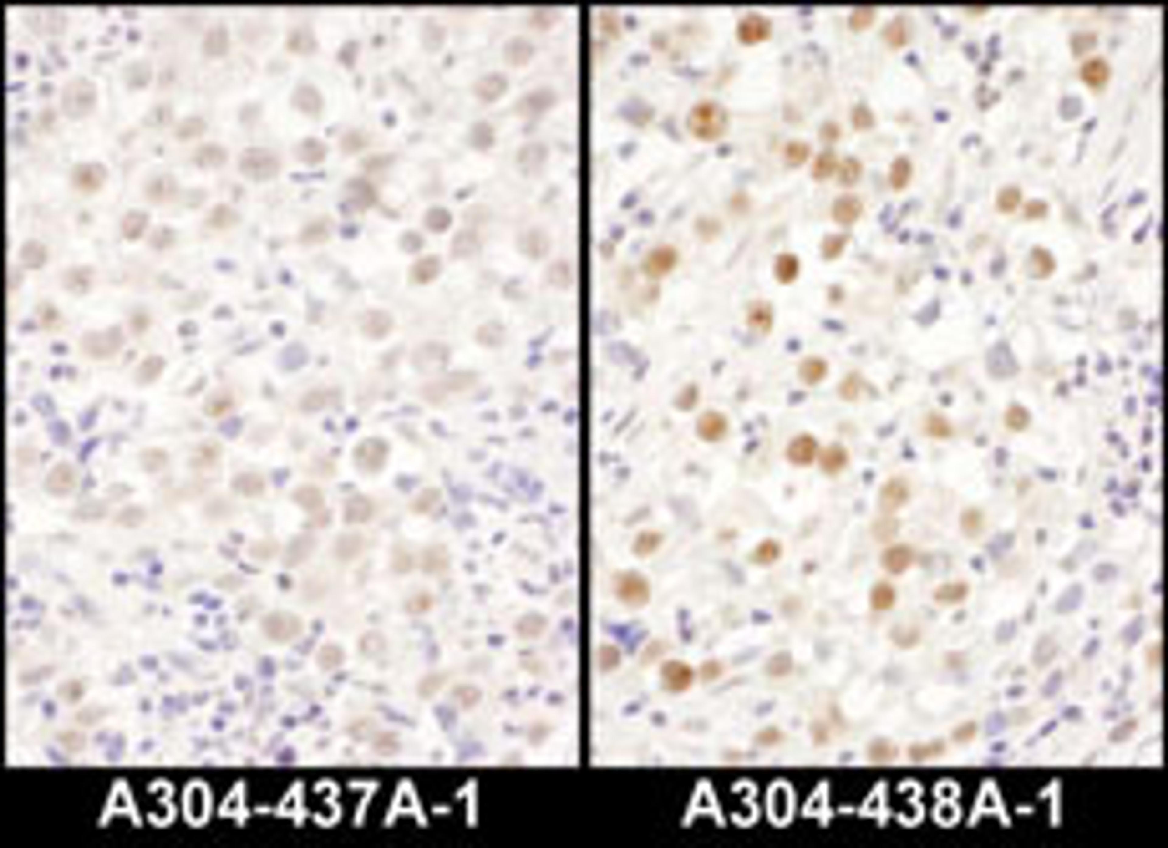 Detection of human LAS1L by immunohistochemistry.