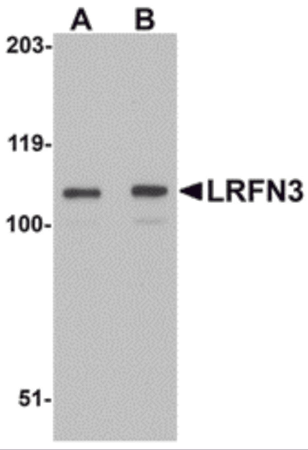 Western blot analysis of LRFN3 in K562 lysate with LRFN3 antibody at (A) 1 and (B) 2 μg/mL.
