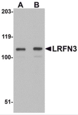 Western blot analysis of LRFN3 in K562 lysate with LRFN3 antibody at (A) 1 and (B) 2 μg/mL.