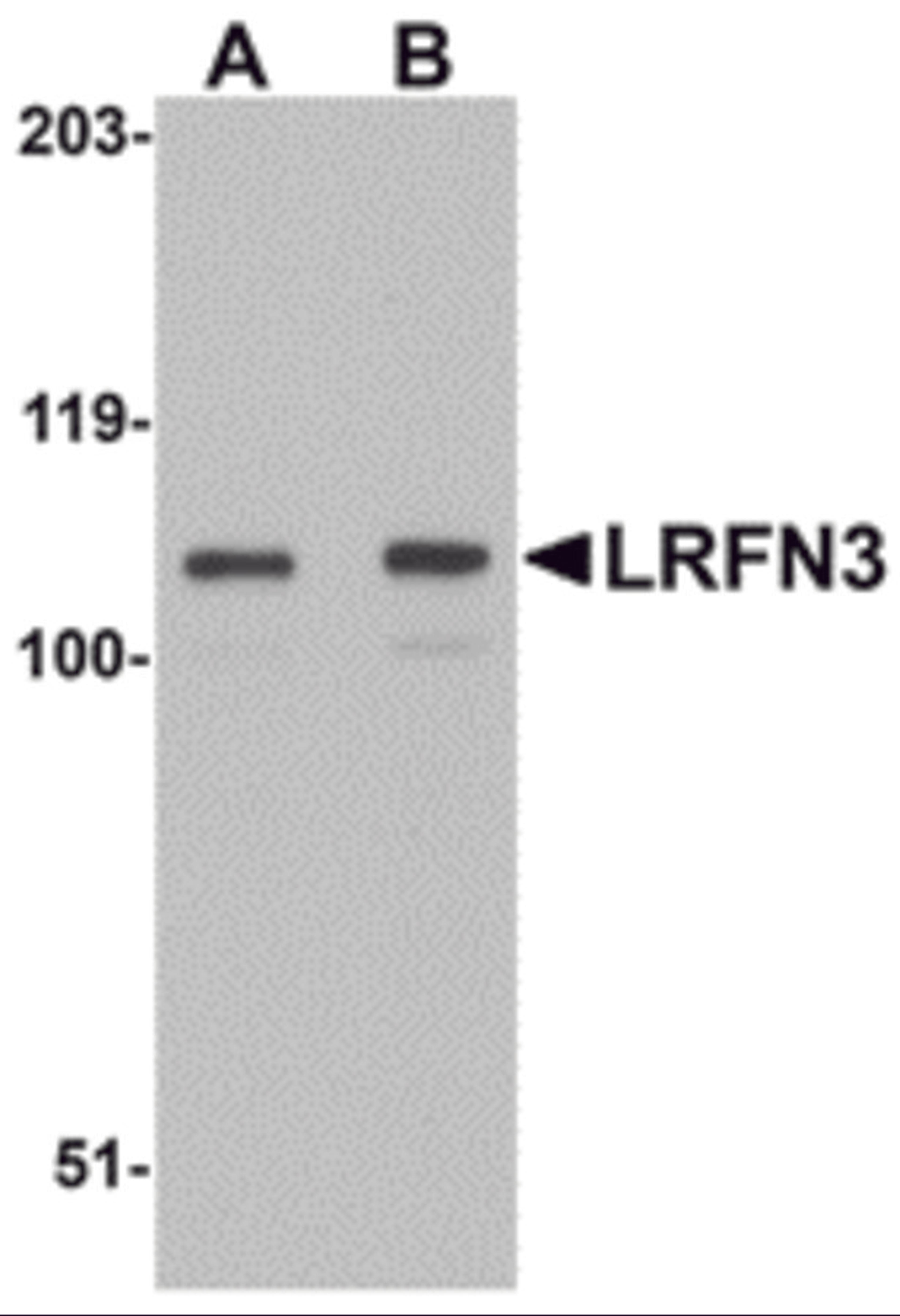 Western blot analysis of LRFN3 in K562 lysate with LRFN3 antibody at (A) 1 and (B) 2 μg/mL.