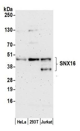 Detection of human SNX16 by WB.