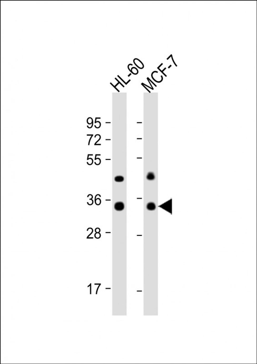 Western Blot at 1:1000 dilution Lane 1: HL-60 whole cell lysate Lane 2: MCF-7 whole cell lysate Lysates/proteins at 20 ug per lane.