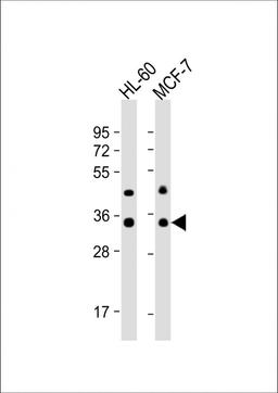 Western Blot at 1:1000 dilution Lane 1: HL-60 whole cell lysate Lane 2: MCF-7 whole cell lysate Lysates/proteins at 20 ug per lane.