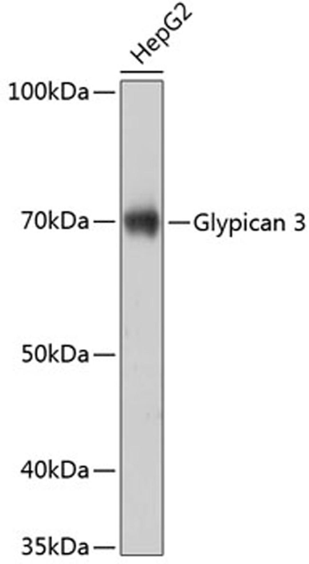 Western blot - Glypican 3 Rabbit mAb (A11686)