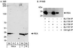 Detection of human and mouse REA by western blot (h & m) and immunoprecipitation (h).