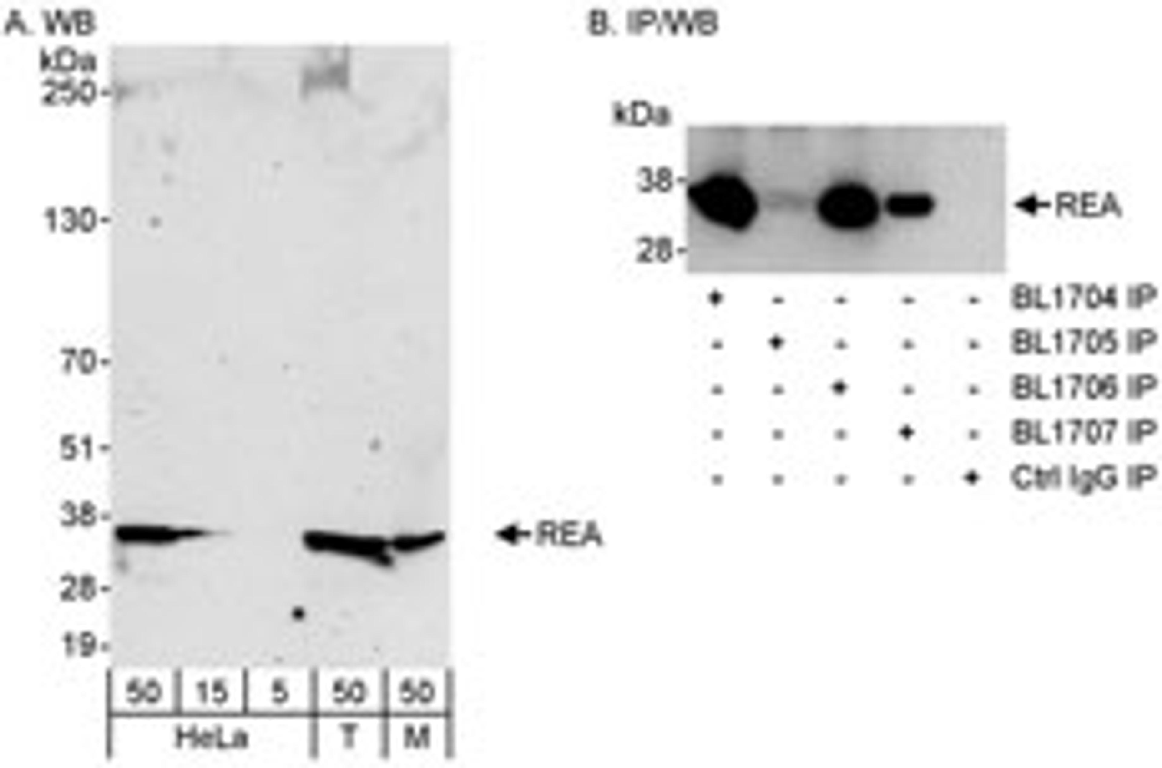 Detection of human and mouse REA by western blot (h & m) and immunoprecipitation (h).