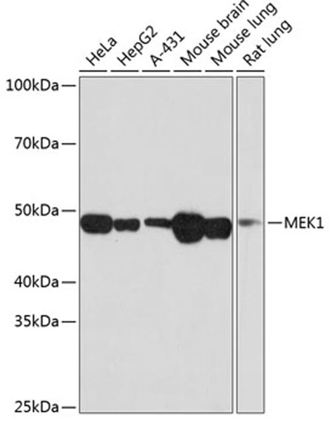 Western blot - MEK1 antibody (A19565)