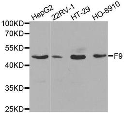 Western blot analysis of extracts of various cell lines using F9 antibody