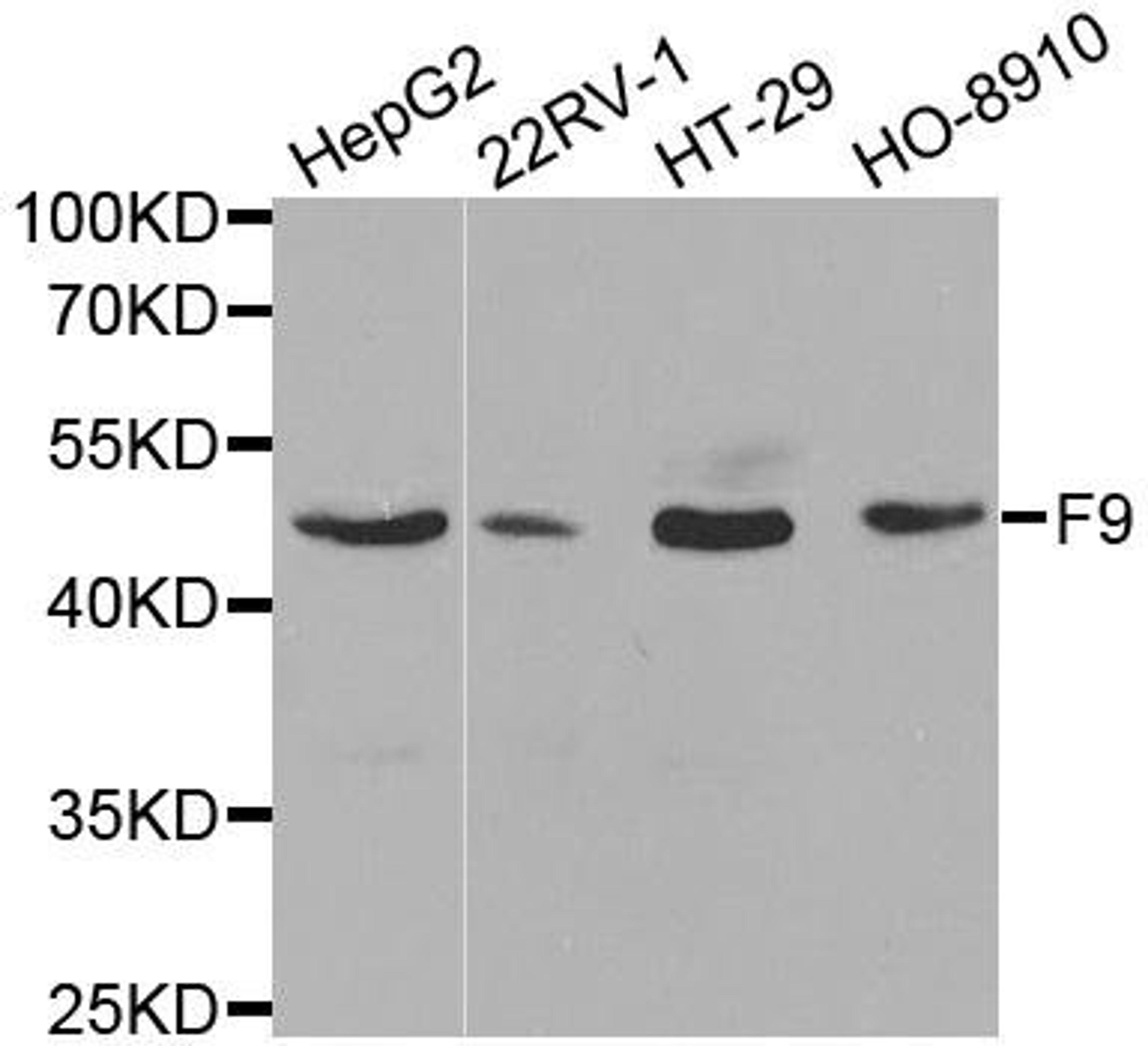 Western blot analysis of extracts of various cell lines using F9 antibody