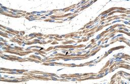 Antibody used in IHC on Human Muscle.