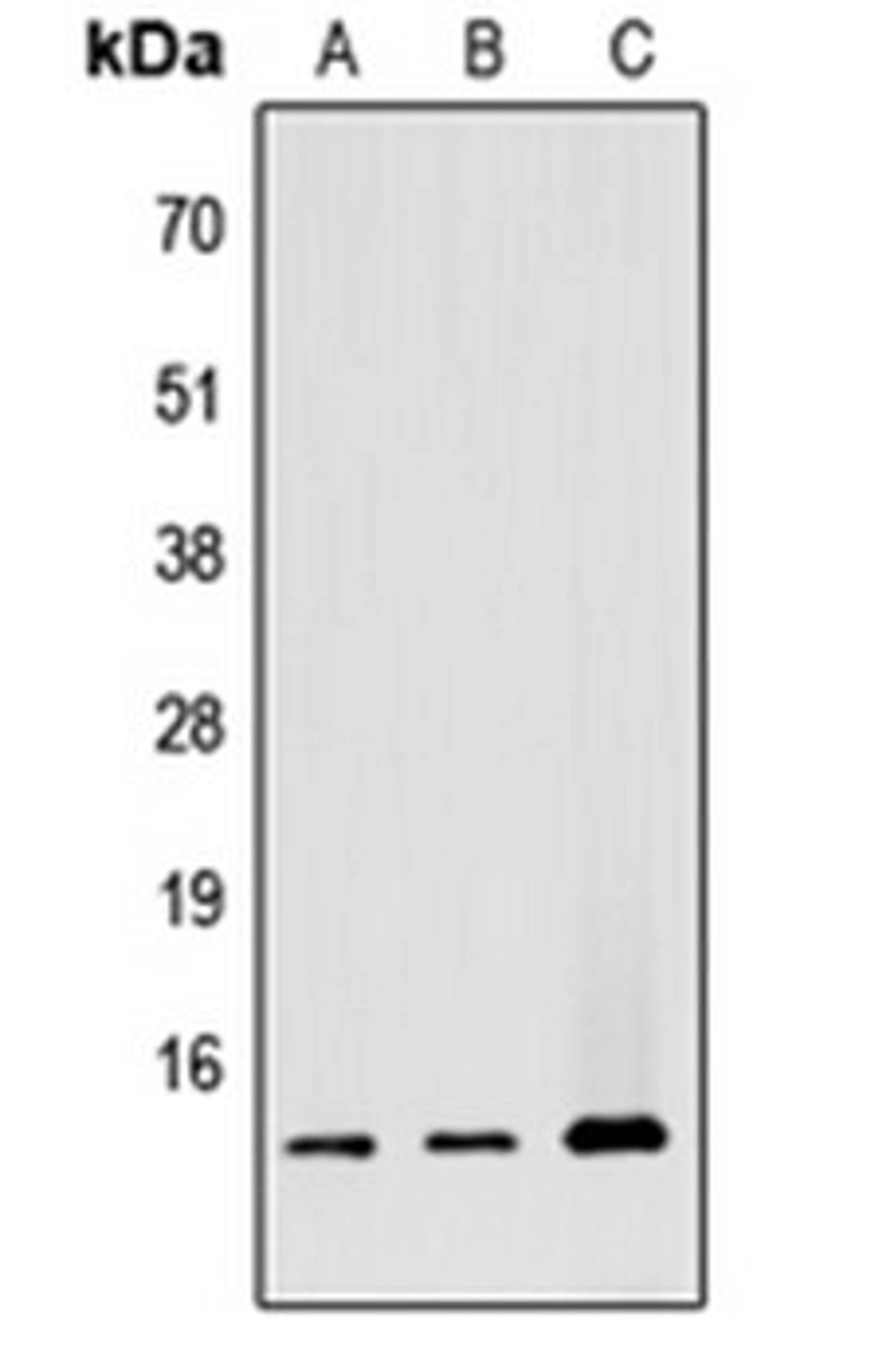 Western blot analysis of HEK293T (Lane 1), Raw264.7 (Lane 2), H9C2 (Lane 3) whole cell lysates using ATP5G1 antibody