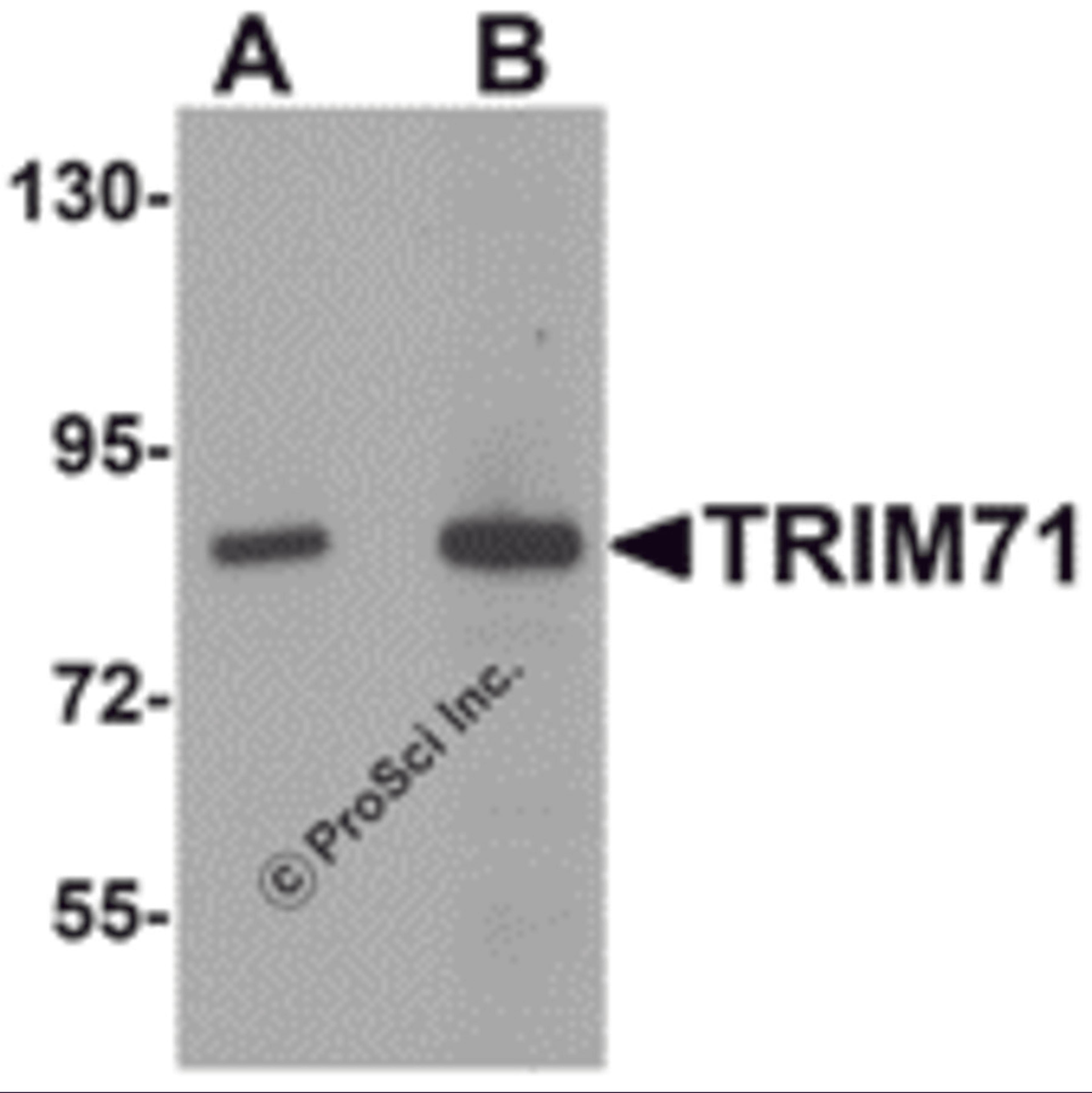 Western blot analysis of TRIM71 in human brain tissue lysate with TRIM71 antibody at (A) 1 and (B) 2 &#956;g/mL.