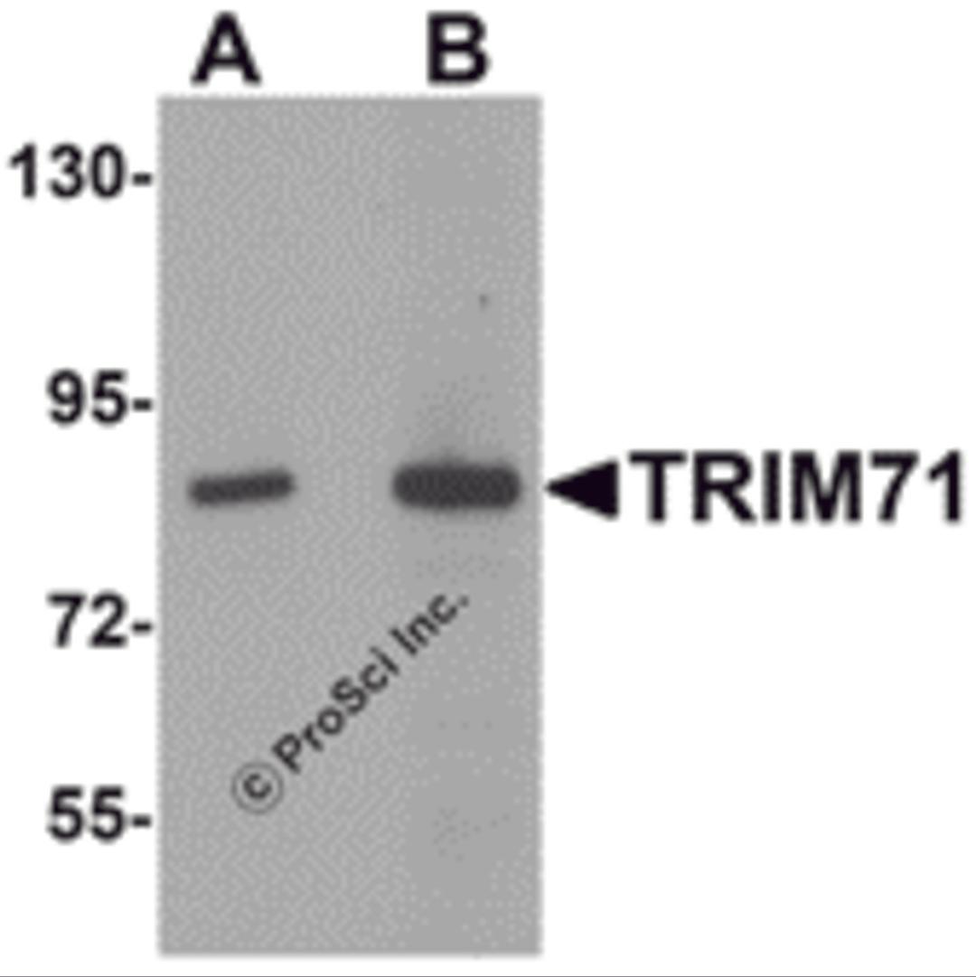 Western blot analysis of TRIM71 in human brain tissue lysate with TRIM71 antibody at (A) 1 and (B) 2 μg/mL.