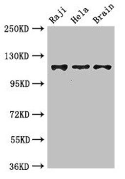 Western Blot. Positive WB detected in: Raji whole cell lysate, Hela whole cell lysate, Mouse brain tissue. All lanes: KIF11 antibody at 3.5ug/ml. Secondary. Goat polyclonal to rabbit IgG at 1/50000 dilution. Predicted band size: 120 kDa. Observed band size: 120 kDa. 
