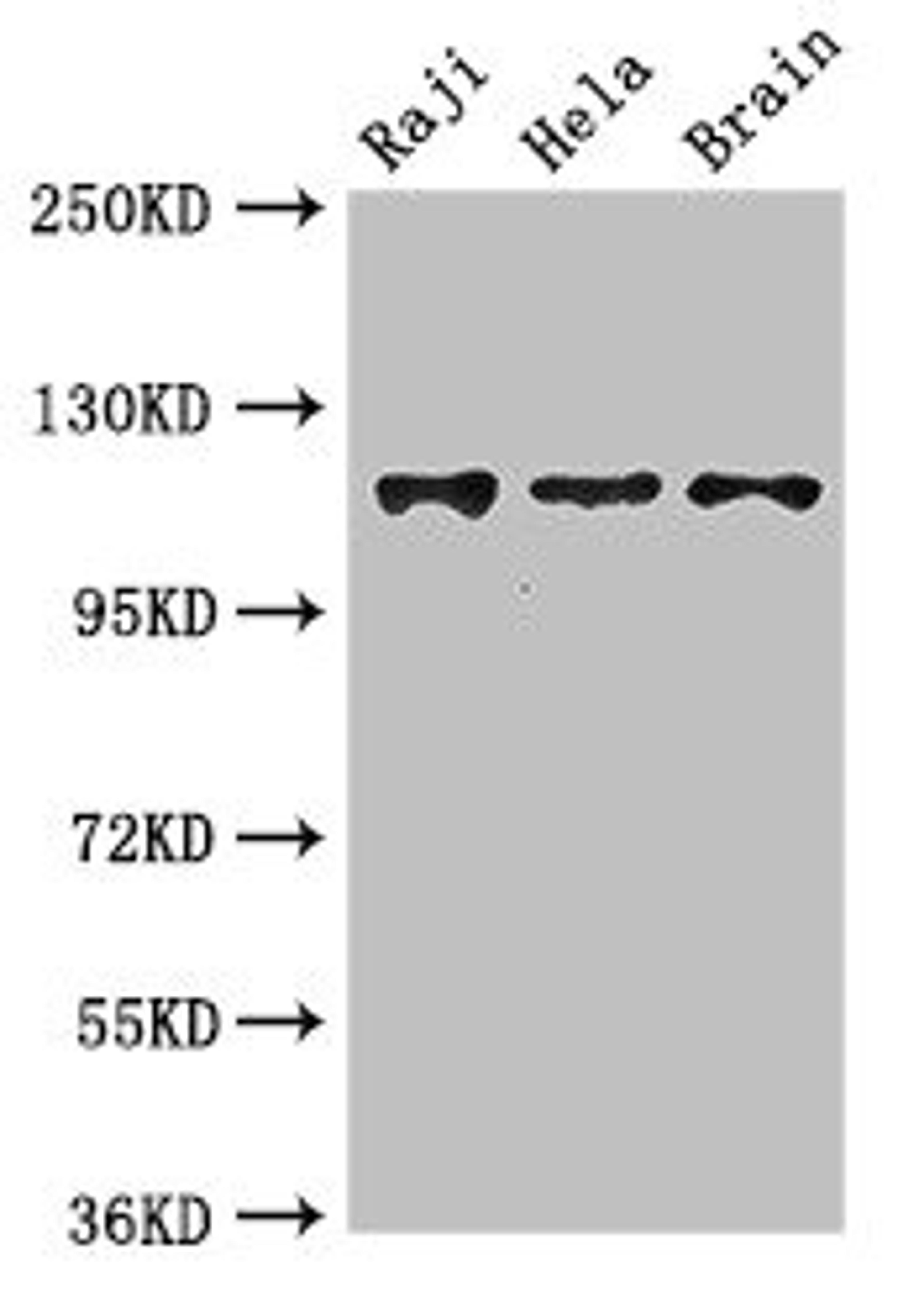 Western Blot. Positive WB detected in: Raji whole cell lysate, Hela whole cell lysate, Mouse brain tissue. All lanes: KIF11 antibody at 3.5ug/ml. Secondary. Goat polyclonal to rabbit IgG at 1/50000 dilution. Predicted band size: 120 kDa. Observed band size: 120 kDa. 