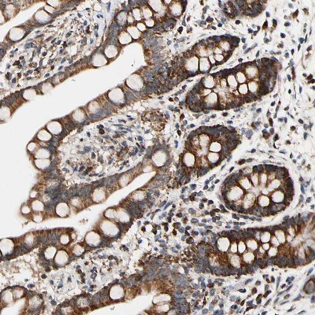 Immunohistochemistry-Paraffin: KIAA0907 Antibody [NBP1-86485] - Staining of human colon shows strong cytoplasmic positivity in glandular cells.