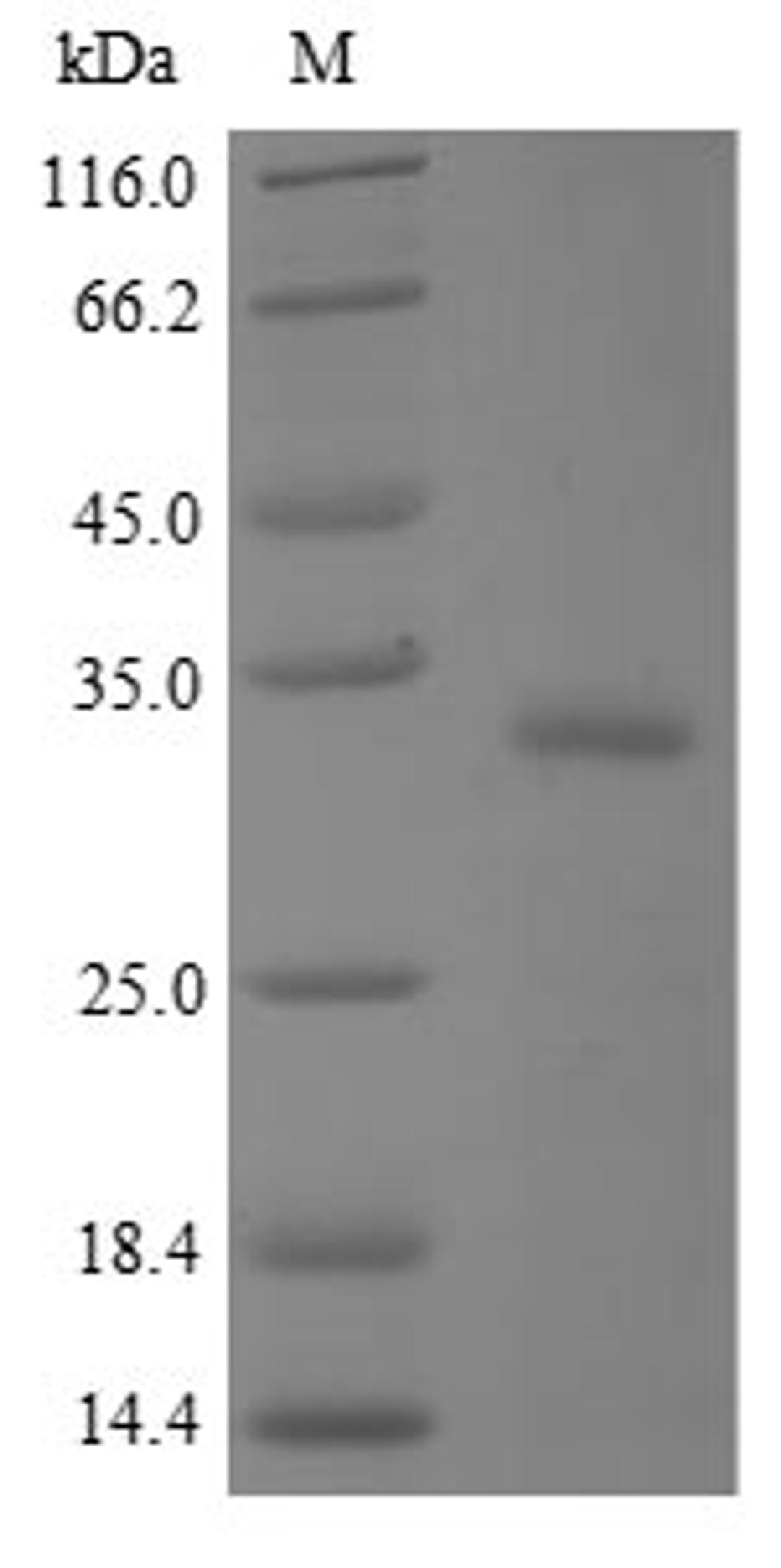 (Tris-Glycine gel) Discontinuous SDS-PAGE (reduced) with 5% enrichment gel and 15% separation gel.