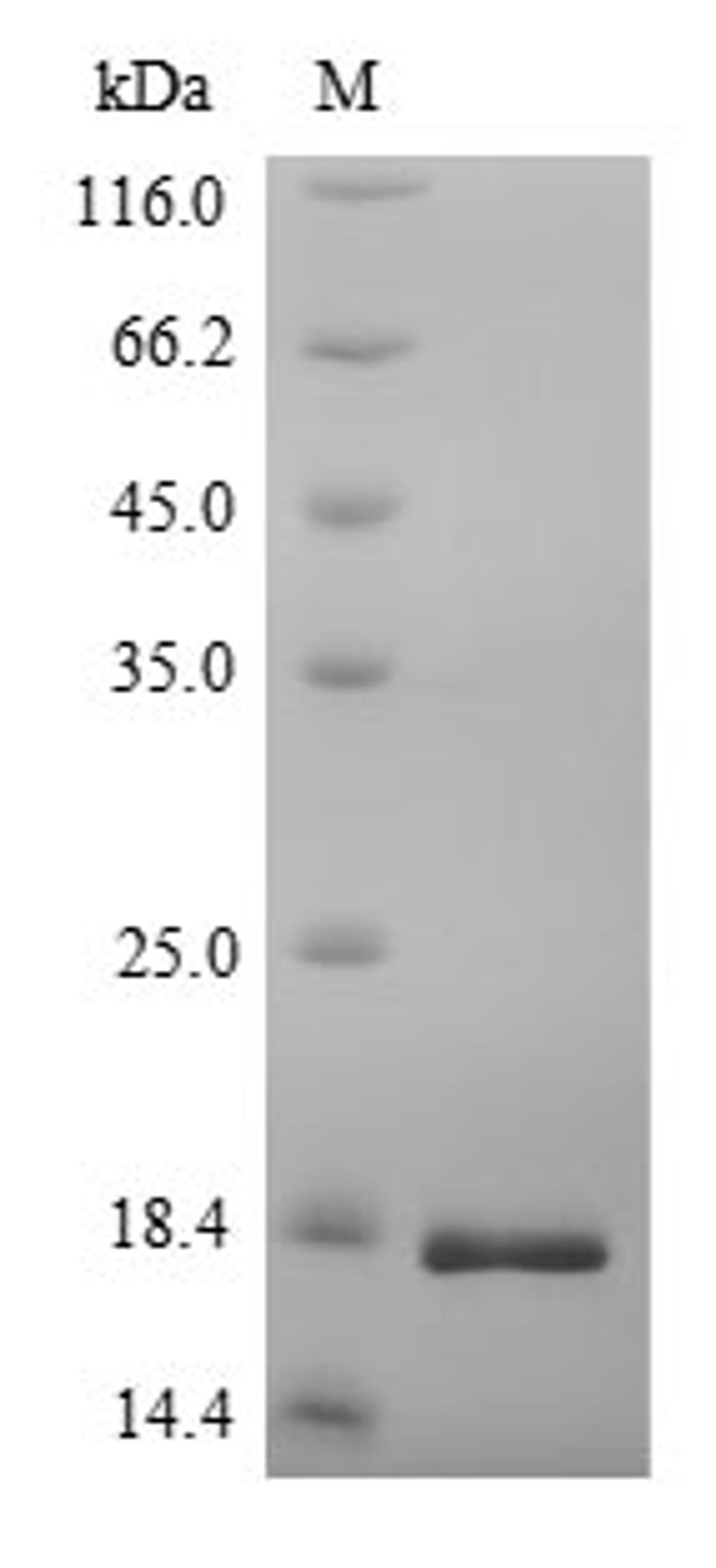 (Tris-Glycine gel) Discontinuous SDS-PAGE (reduced) with 5% enrichment gel and 15% separation gel.
