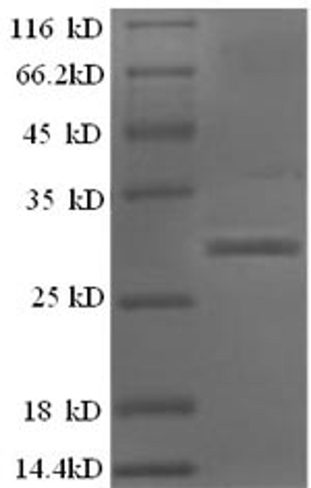 (Tris-Glycine gel) Discontinuous SDS-PAGE (reduced) with 5% enrichment gel and 15% separation gel.