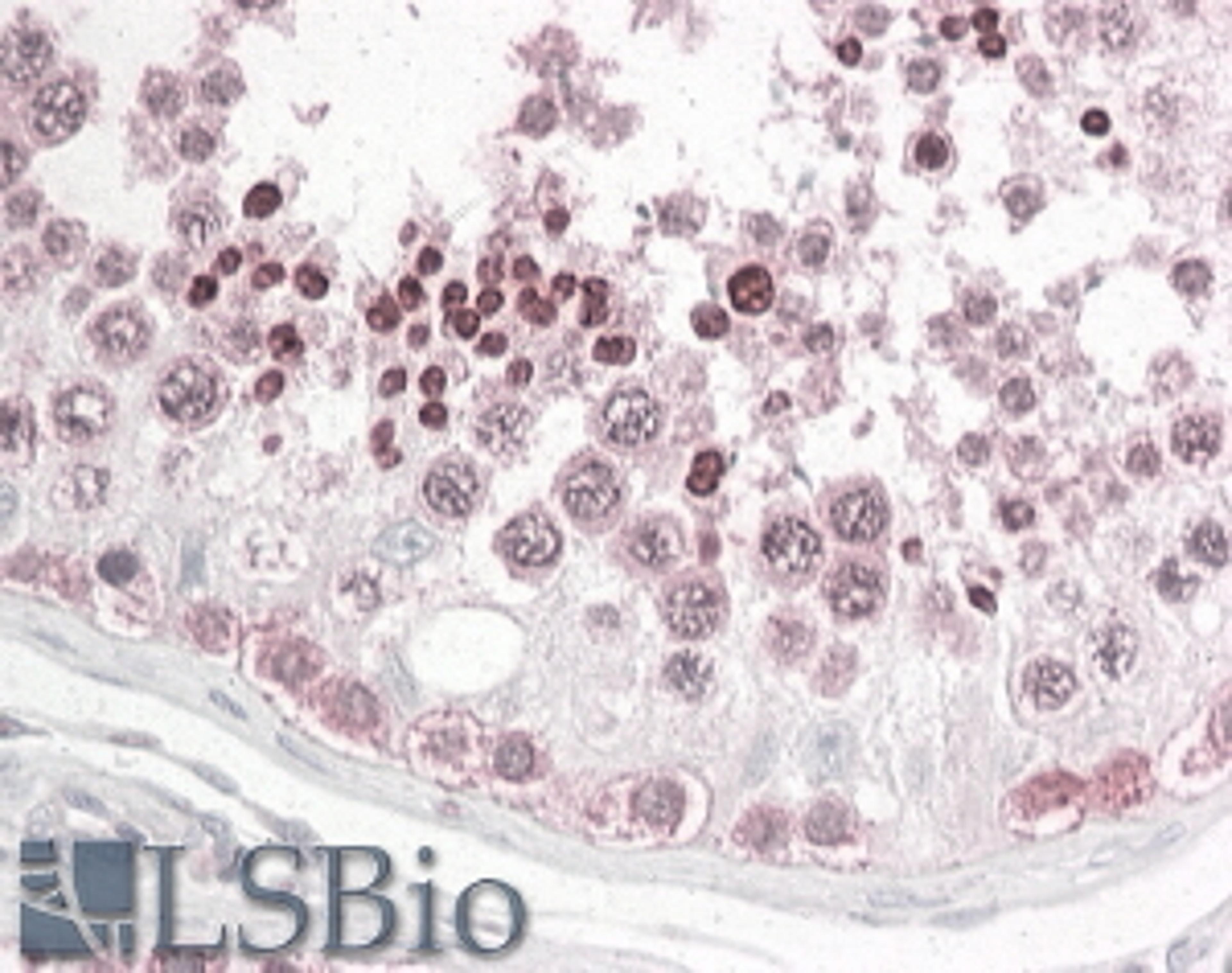 45-772 (3.8ug/ml) staining of paraffin embedded Human Testis. Steamed antigen retrieval with citrate buffer pH 6, AP-staining.