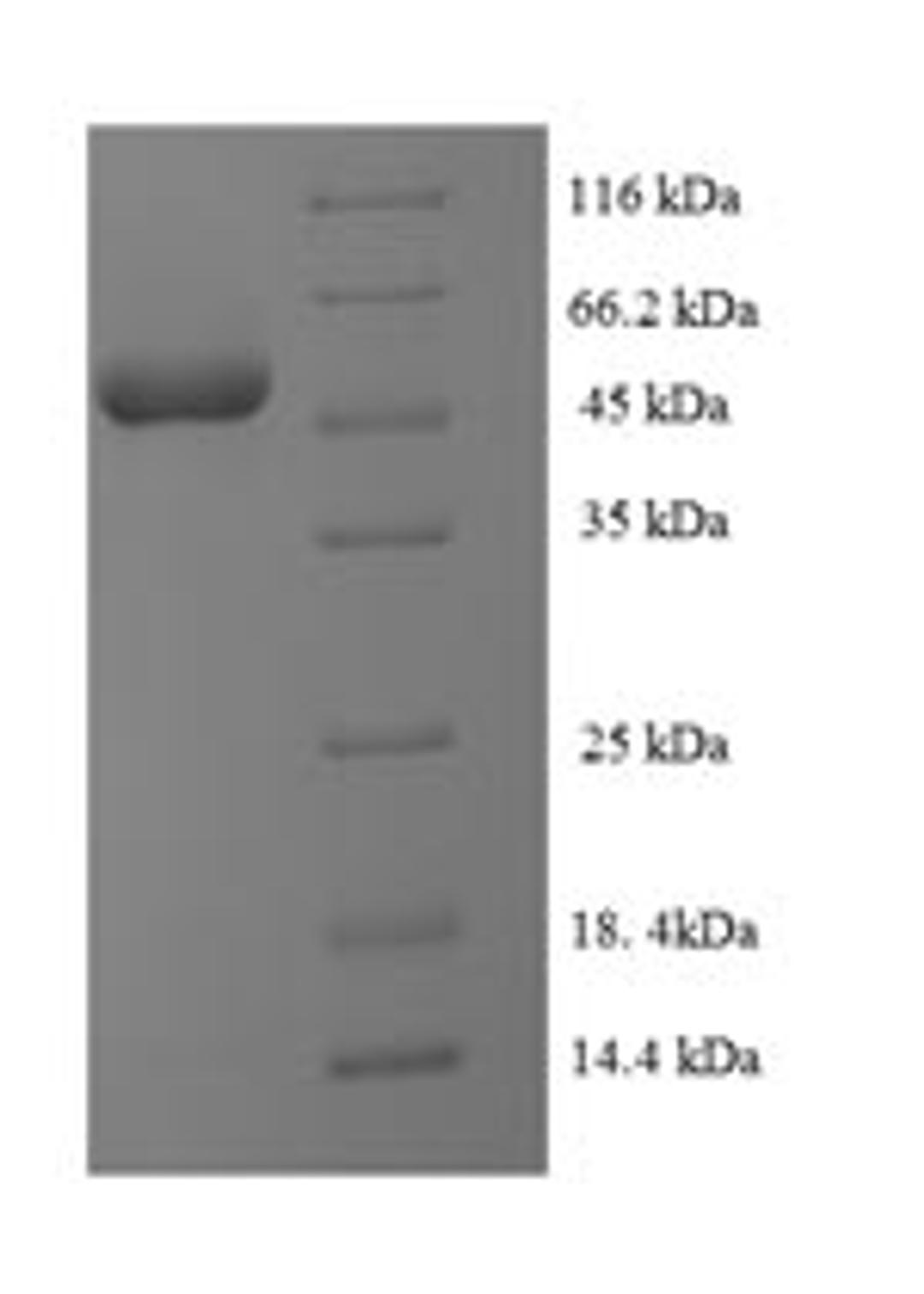 (Tris-Glycine gel) Discontinuous SDS-PAGE (reduced) with 5% enrichment gel and 15% separation gel.