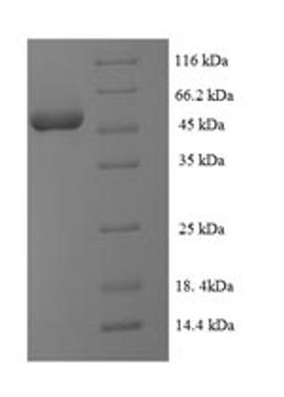 (Tris-Glycine gel) Discontinuous SDS-PAGE (reduced) with 5% enrichment gel and 15% separation gel.