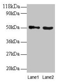 Western blot. All lanes: VOPP1 antibody at 2µg/ml. Lane 1: EC109 whole cell lysate. Lane 2: 293T whole cell lysate. Secondary. Goat polyclonal to rabbit IgG at 1/15000 dilution. Predicted band size: 20, 19, 18 kDa. Observed band size: 50 kDa