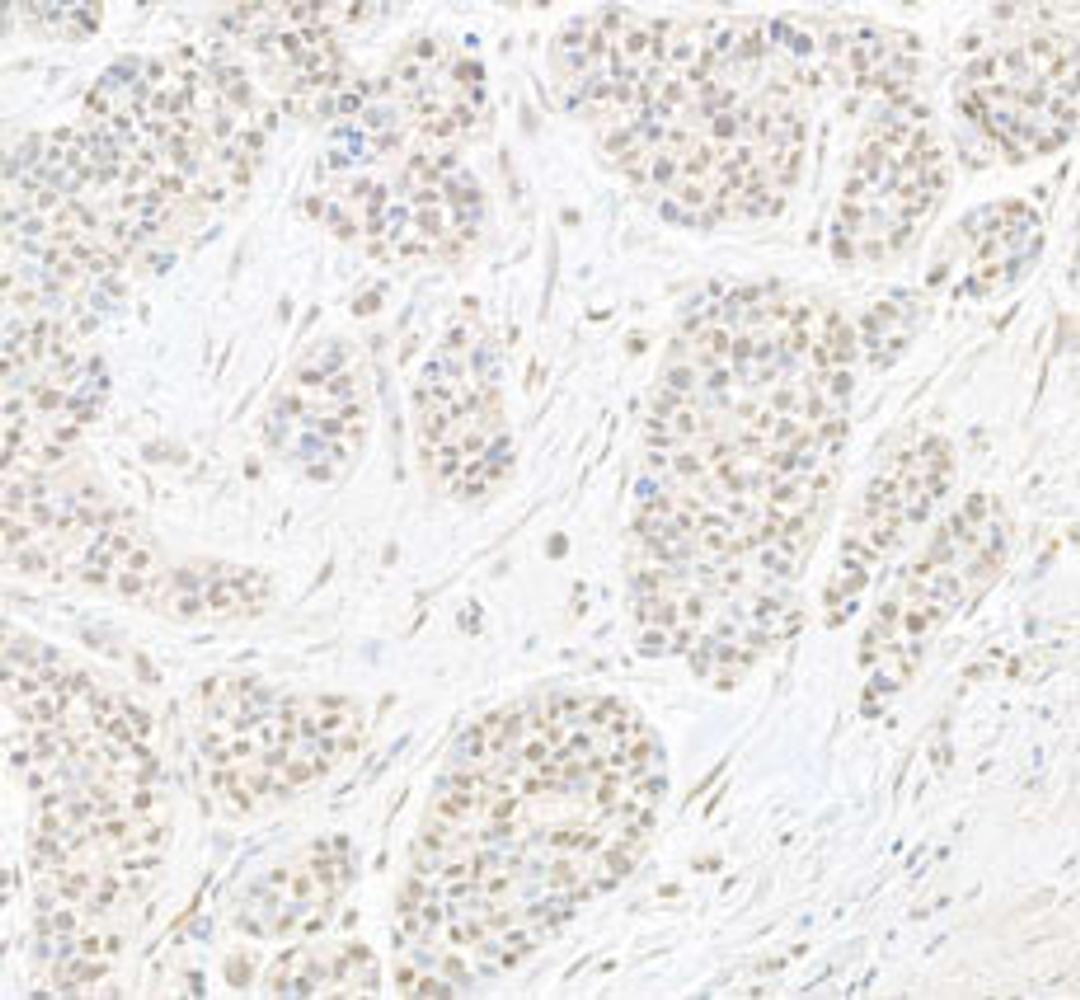 Detection of human B-Myb by immunohistochemistry.