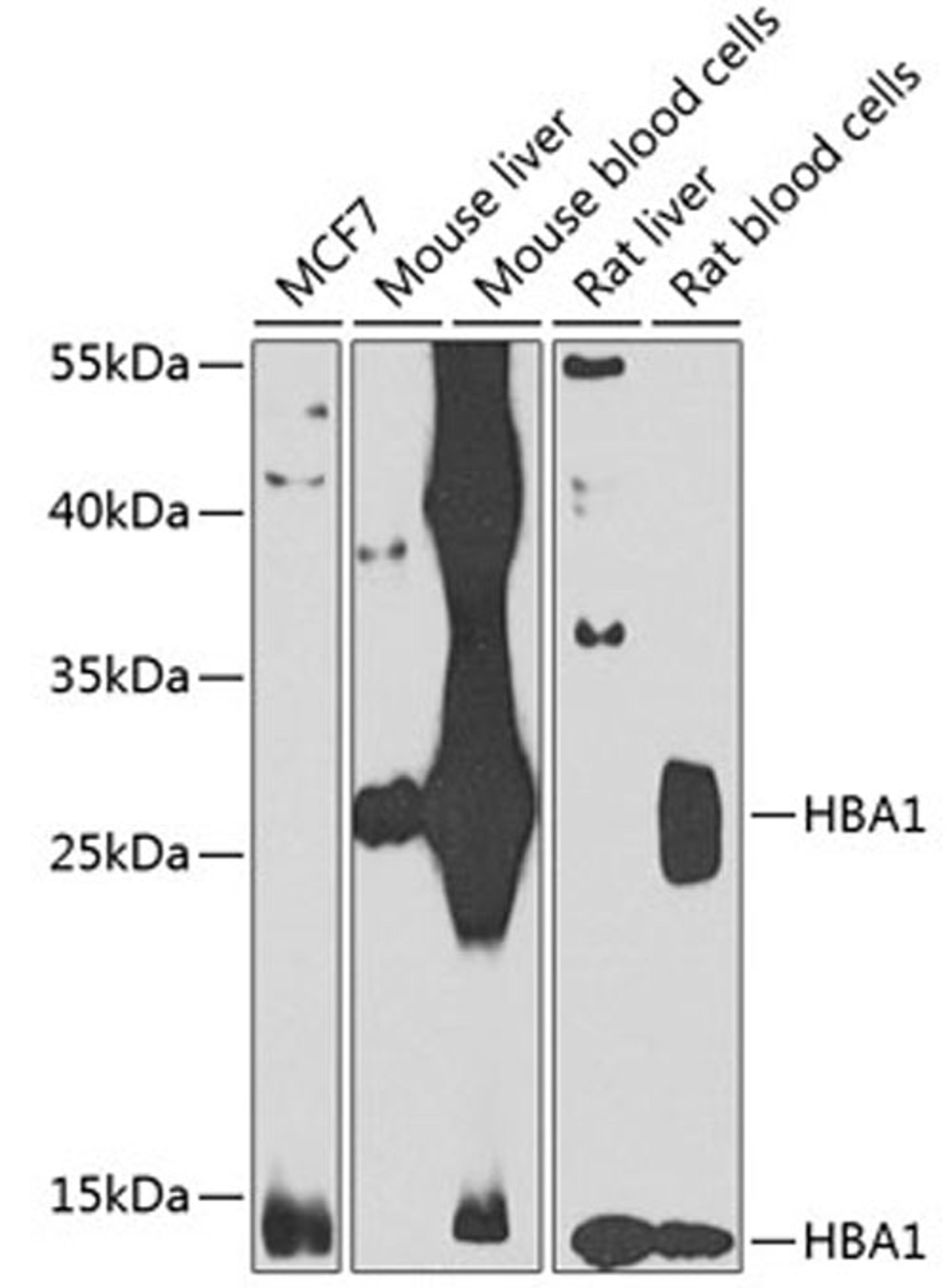 Western blot - HBA1 antibody (A7322)