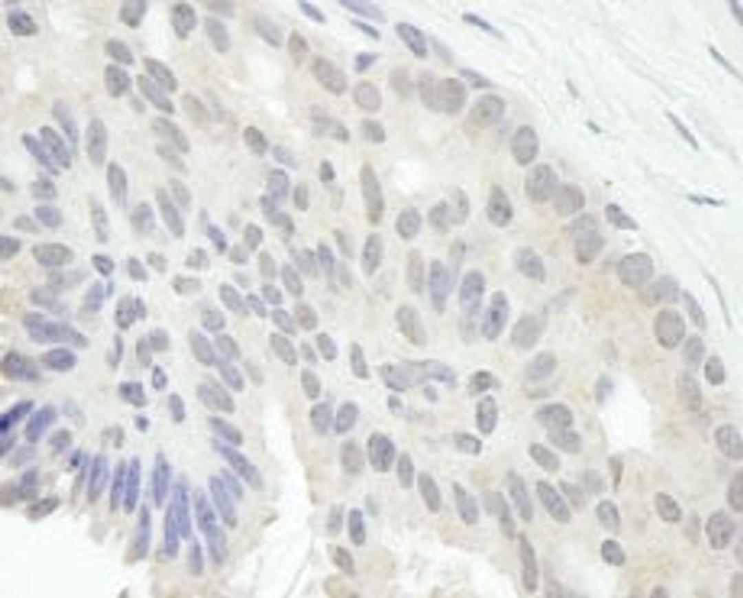 Detection of human E2F1 by immunohistochemistry.