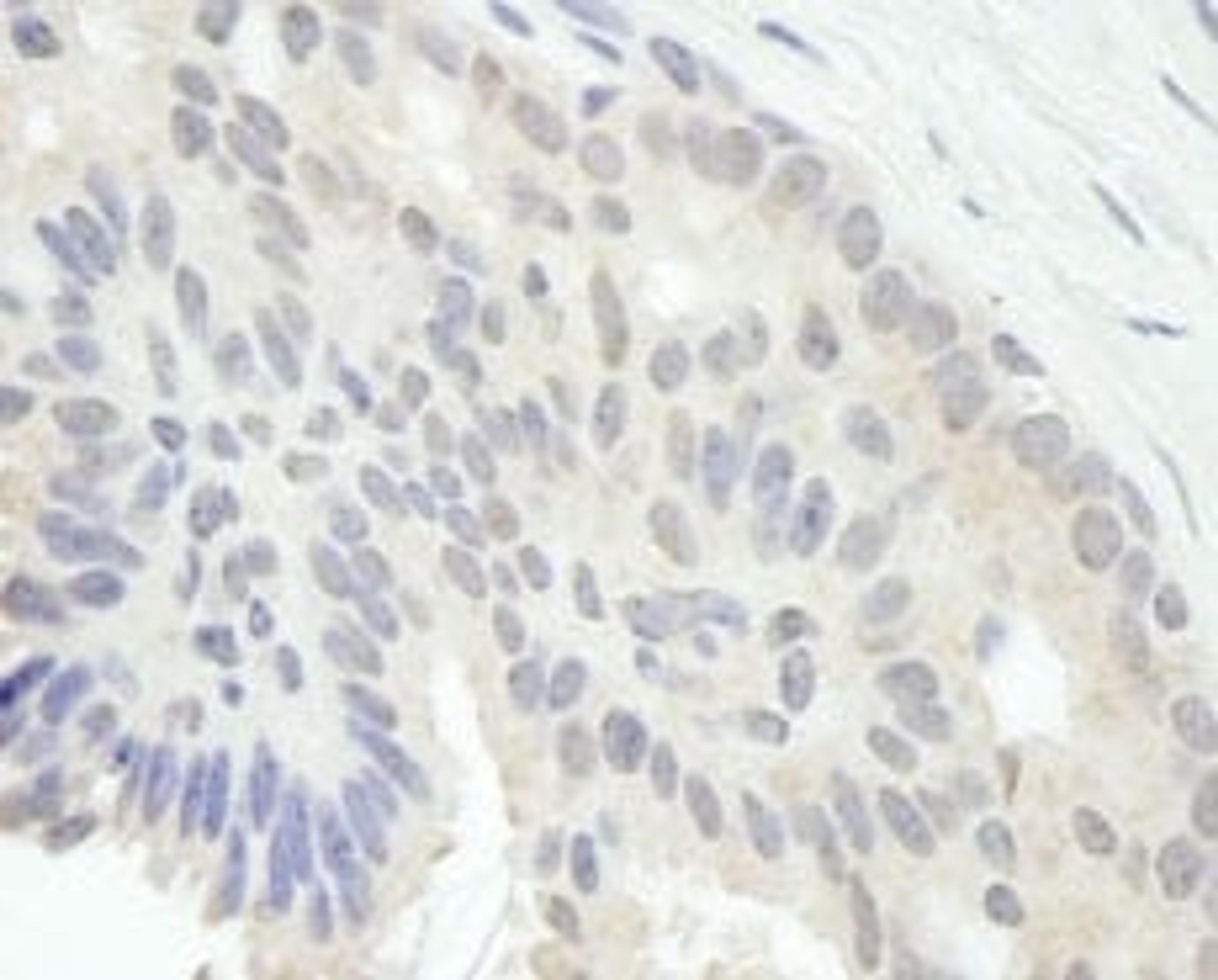 Detection of human E2F1 by immunohistochemistry.