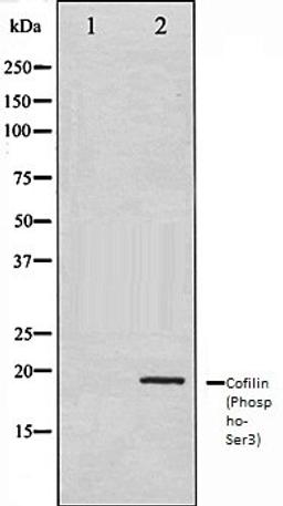 Western blot analysis of COLO205 whole cell lysates using Cofilin (Phospho-Ser3) antibody, The lane on the left is treated with the antigen-specific peptide.