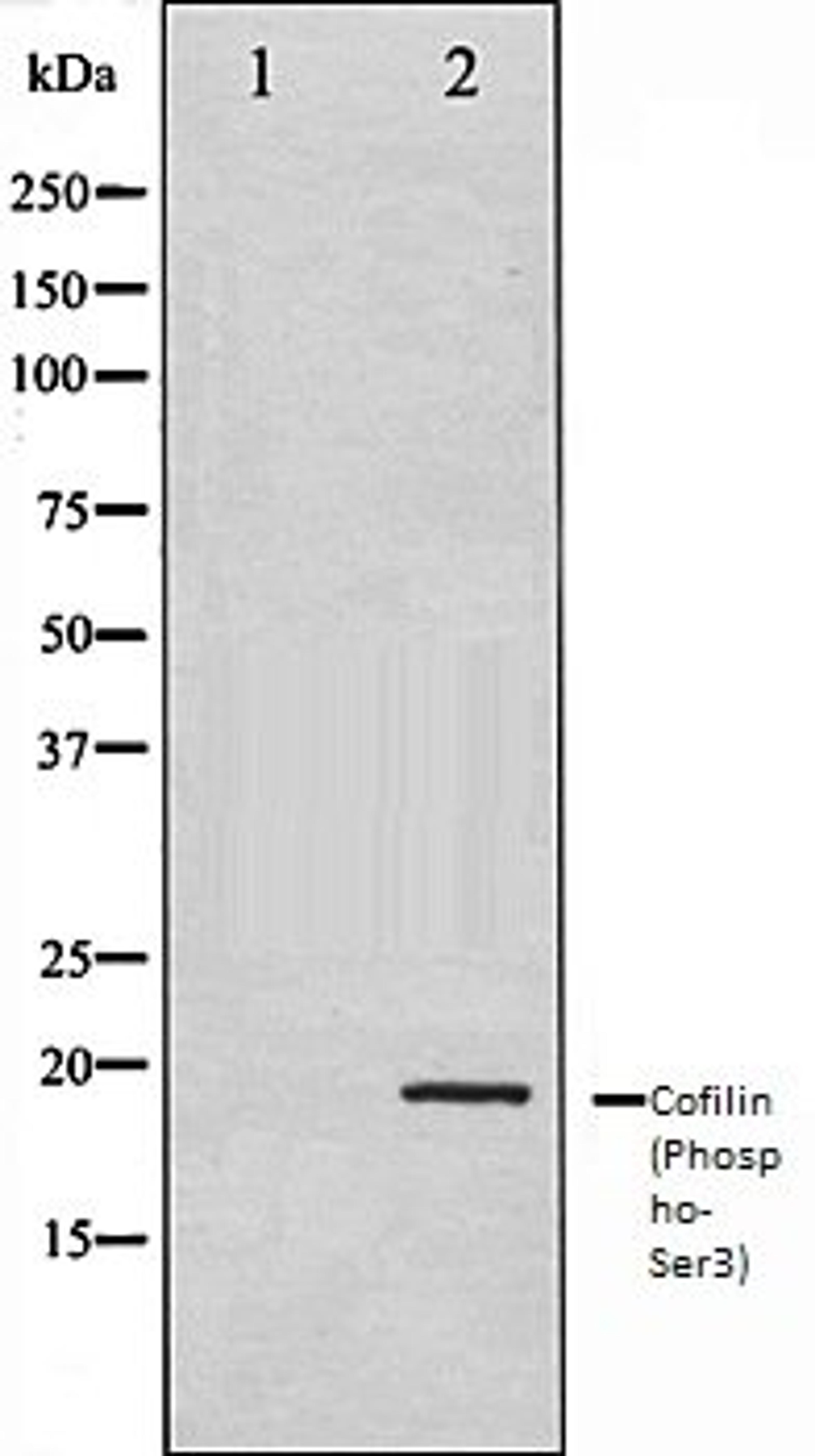 Western blot analysis of COLO205 whole cell lysates using Cofilin (Phospho-Ser3) antibody, The lane on the left is treated with the antigen-specific peptide.