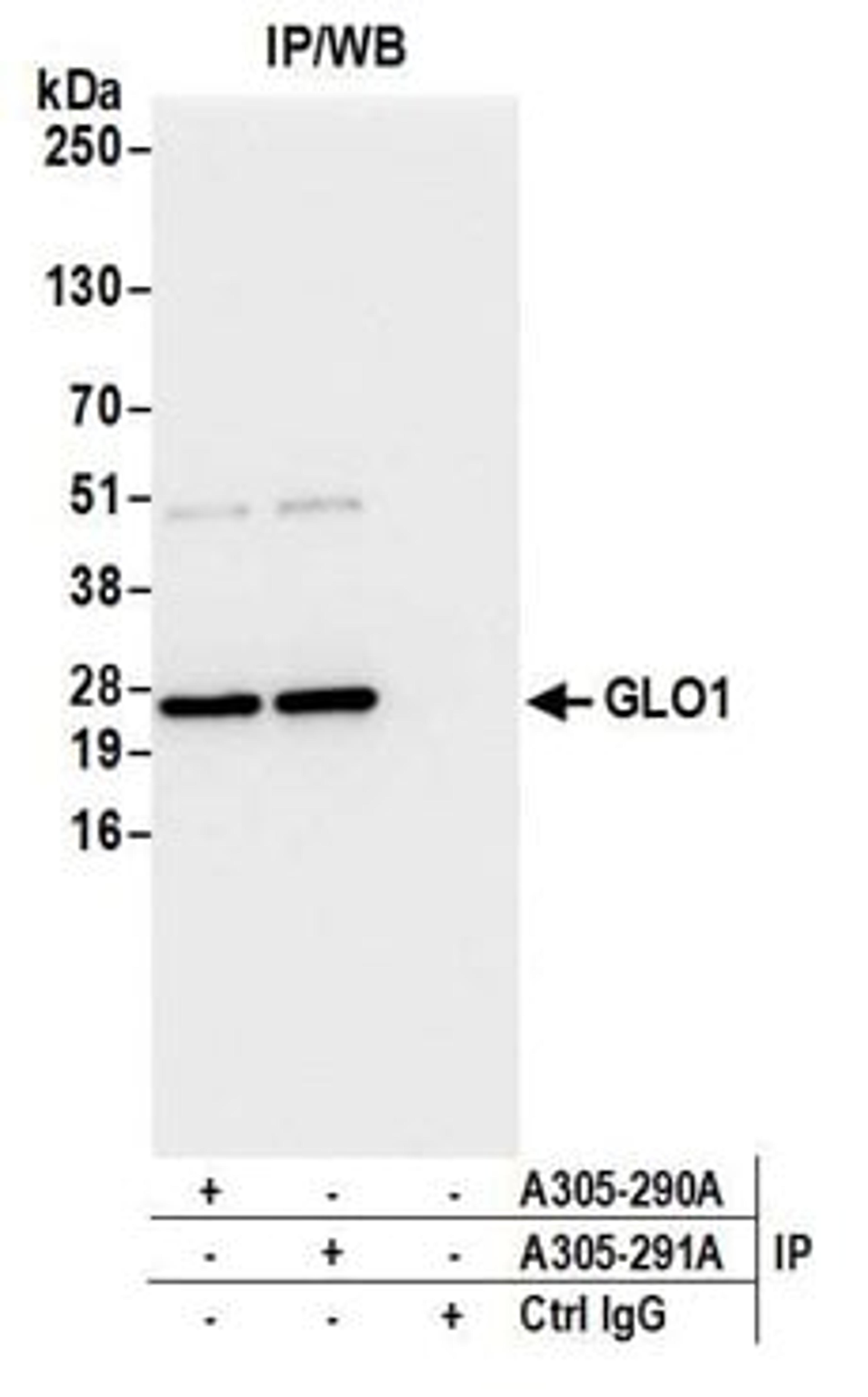 Detection of human GLO1/Glyoxalase I by western blot of immunoprecipitates.