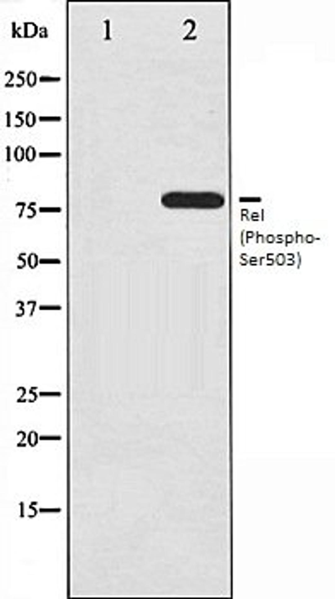 Western blot analysis of MDA-MB-435 whole cell lysates using Rel (Phospho-Ser503) antibody, The lane on the left is treated with the antigen-specific peptide.