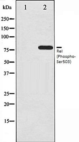 Western blot analysis of MDA-MB-435 whole cell lysates using Rel (Phospho-Ser503) antibody, The lane on the left is treated with the antigen-specific peptide.