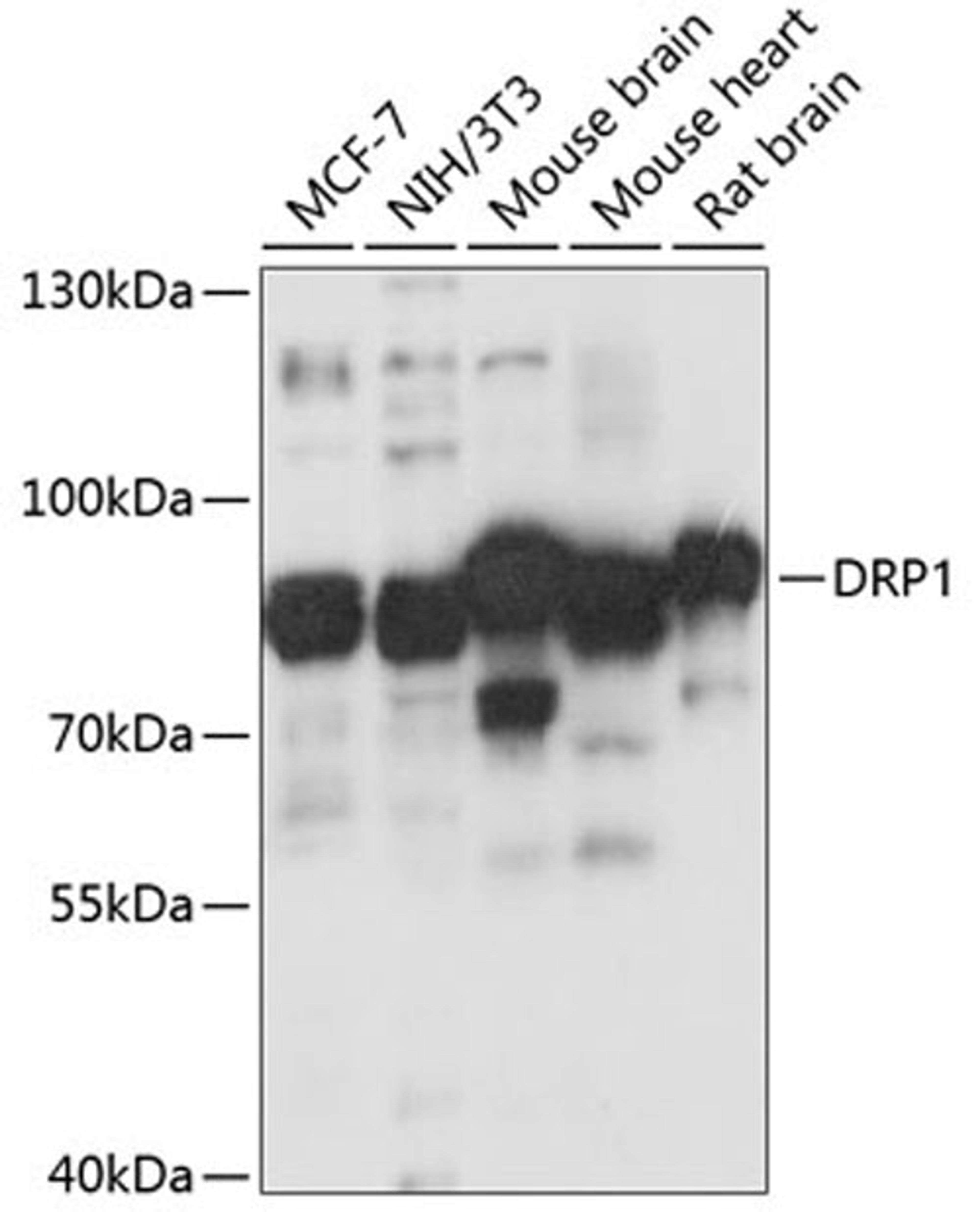 Western blot - DRP1 antibody (A16661)