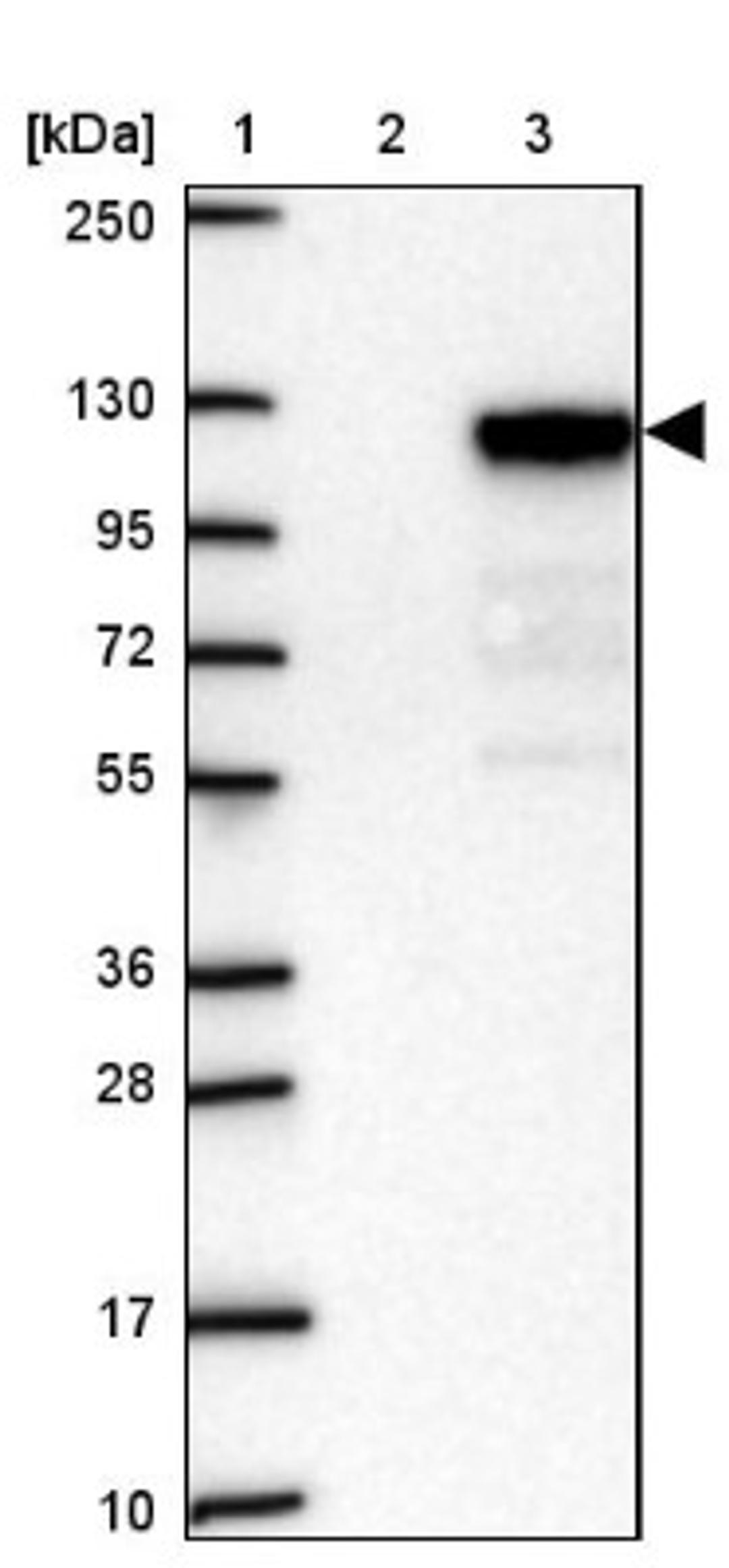 Western Blot: SPICE1 Antibody [NBP2-39035] - Lane 1: Marker [kDa] 250, 130, 95, 72, 55, 36, 28, 17, 10<br/>Lane 2: Negative Control<br/>Lane 3: LY408168