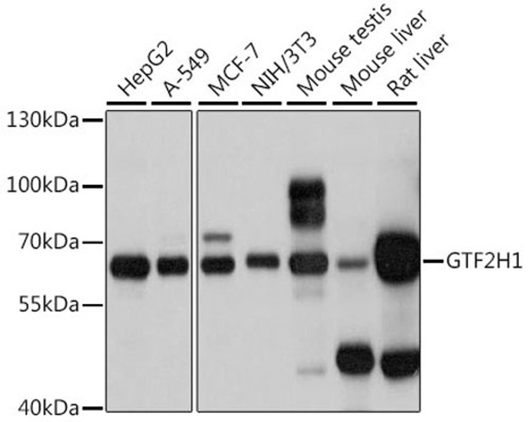 Western blot - GTF2H1 antibody (A6814)